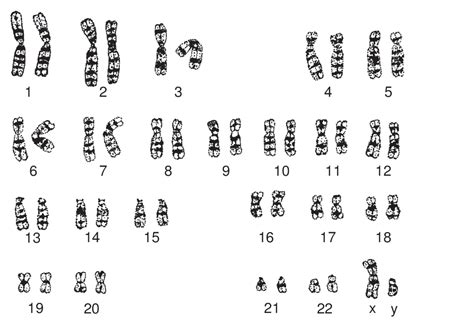 Hvor mange kromosomer har et menneske
